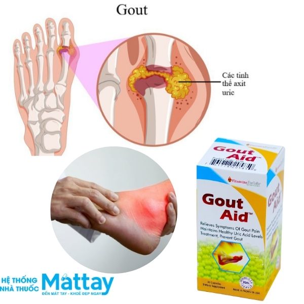 Gout Aid - Chai 30 Viên- Hỗ trợ phòng và điều trị Gout