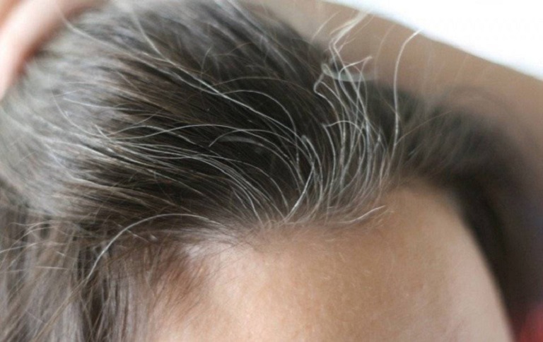 Các nguyên nhân gây bạc tóc sớm ở nam giới  Thuốc nhuộm tóc Gony